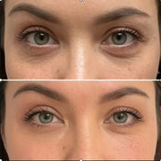 crème contre les rides, les pauches et les contours des yeux