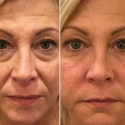 crème contre les rides, les pauches et les contours des yeux